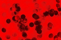 パルボウイルスは細胞分裂が激しい腸に住みつく
